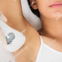 Laser Hair Removal