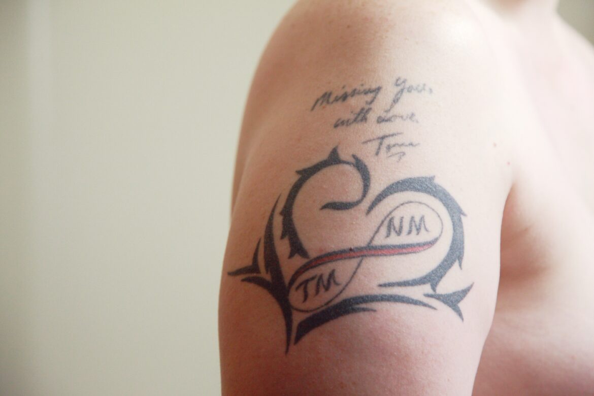 Tattoo Regrets? Sunnyside Skin Clinic Has Your Back!