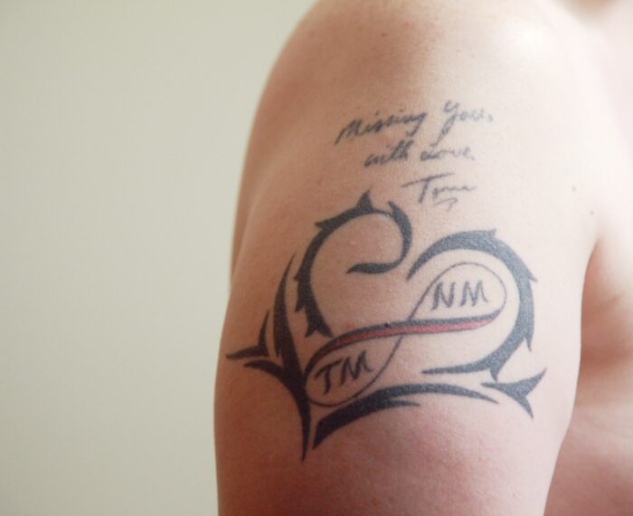 Tattoo Regrets? Sunnyside Skin Clinic Has Your Back!